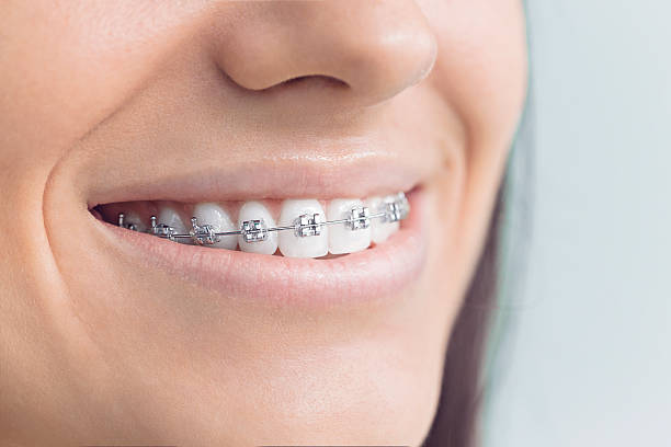 Best Teeth Whitening  in Vernonia, OR